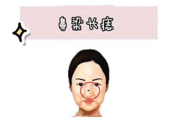 痣相妨夫是真的吗？探索民间信仰与科学视角