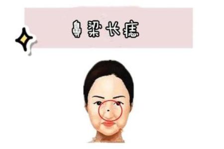 痣相妨夫是真的吗？探索民间信仰与科学视角