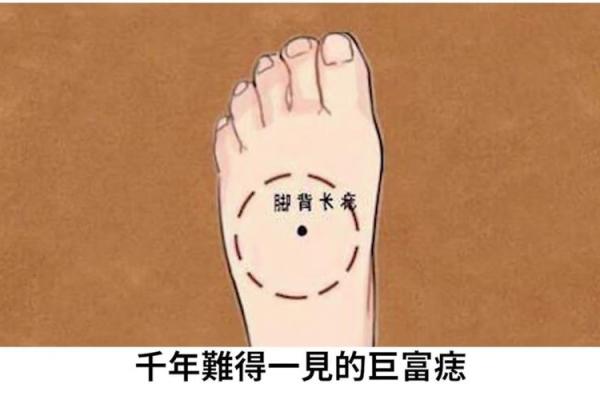 脚部痣相与人生轨迹：它们能告诉你什么